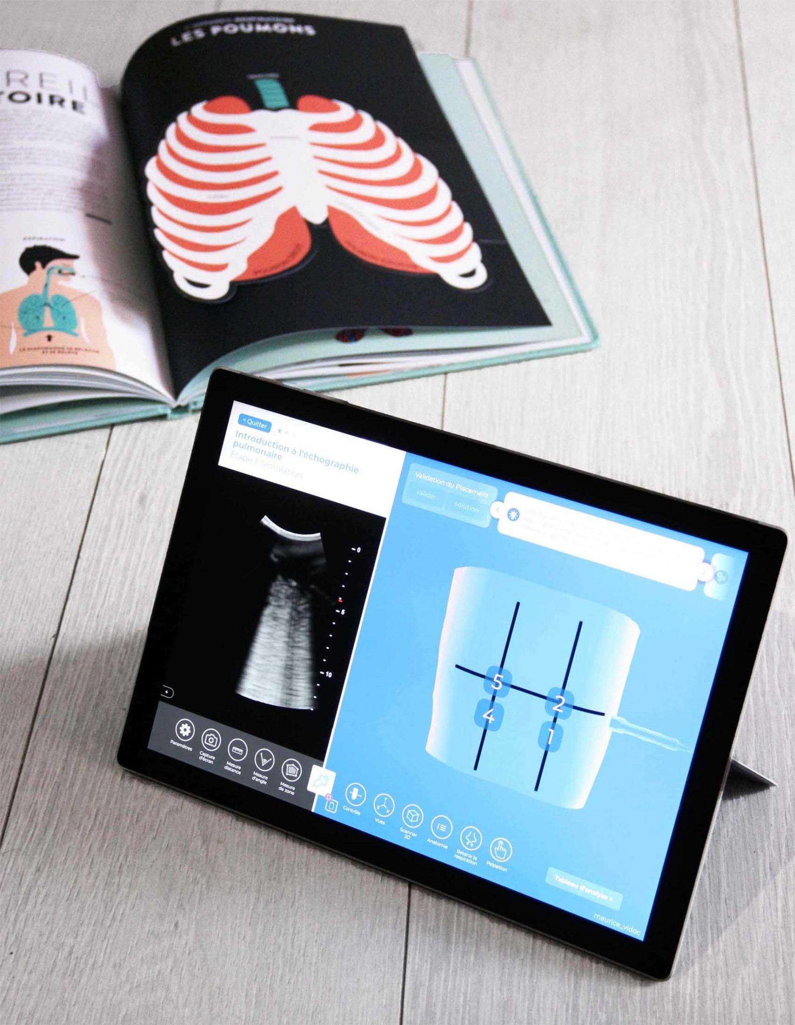 Lung Ultrasound Using The POCUS Protocol